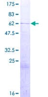 Human HMG20B / BRAF35 Protein (Recombinant GST)
