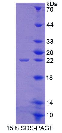Human ABCE1 Protein (Recombinant His-T7, N-terminus)