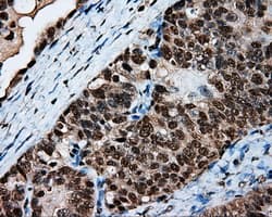 Monoclonal Mouse anti-Human LTA4H / LTA4 Antibody (clone OTI6B5, IHC, WB)