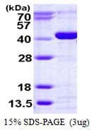 Human CANT1 Protein (Recombinant His)