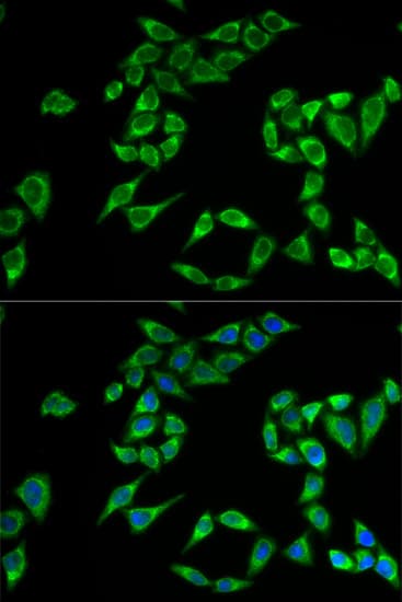 PHLDA2 / TSSC3 Antibody