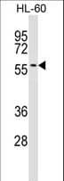 IFRD2 Antibody (aa478-506)