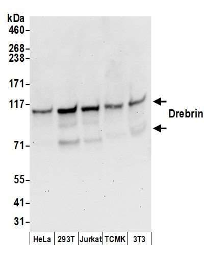 DBN1 / Drebrin Antibody (aa599-649)