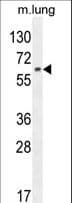 Polyclonal Rabbit anti-Human TCF11 / NFE2L1 Antibody (aa709-738, WB)