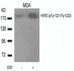 ERBB2 / HER2 Antibody