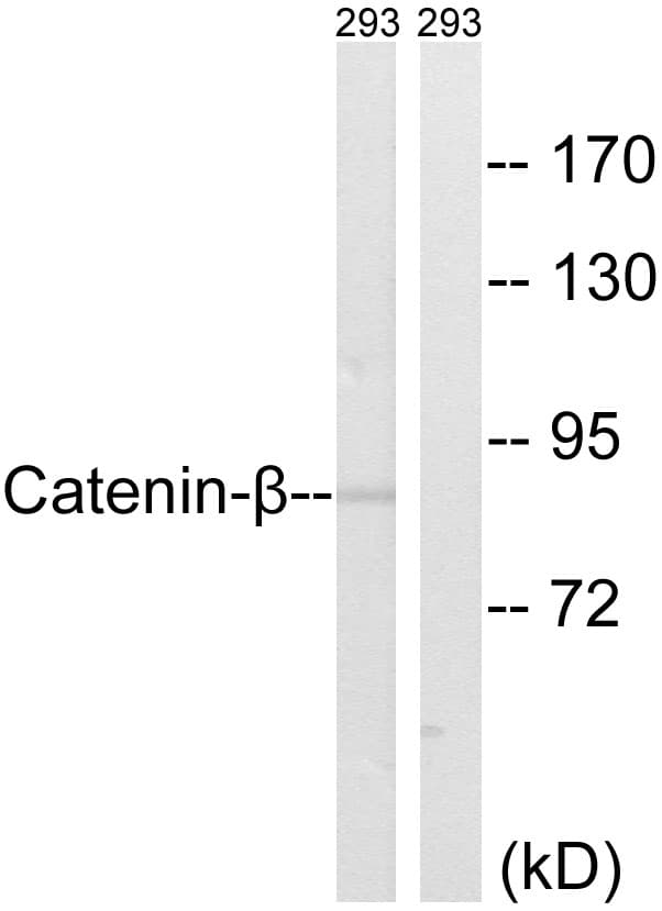 CTNNB1 / Beta Catenin Antibody (aa455-504)