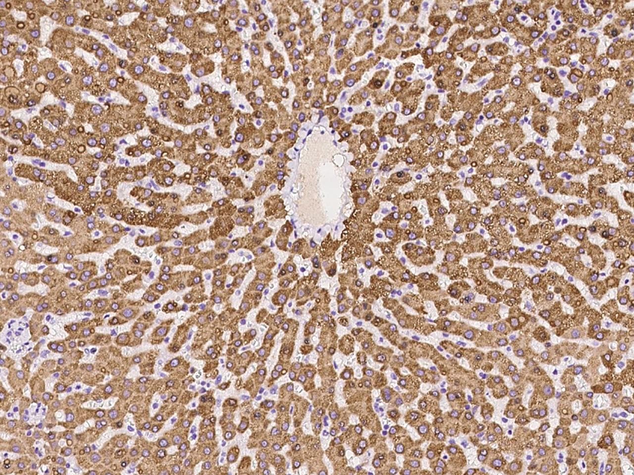ADAMTS13 Antibody