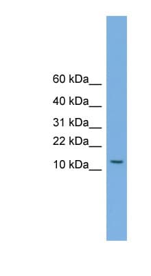 Polyclonal Rabbit anti-Human MAGEA5 Antibody (N-Terminus, WB)