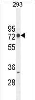 Polyclonal Rabbit anti-Human ZNF780A Antibody (aa54-83, WB)