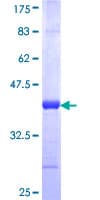 Human JARID2 / JMJ Protein (Recombinant GST, N-terminus)