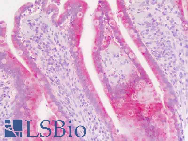 IHC-plus™ MICA Antibody (aa68-97)