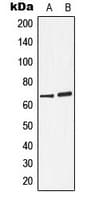 ARSD / Arylsulfatase D Antibody (Internal)