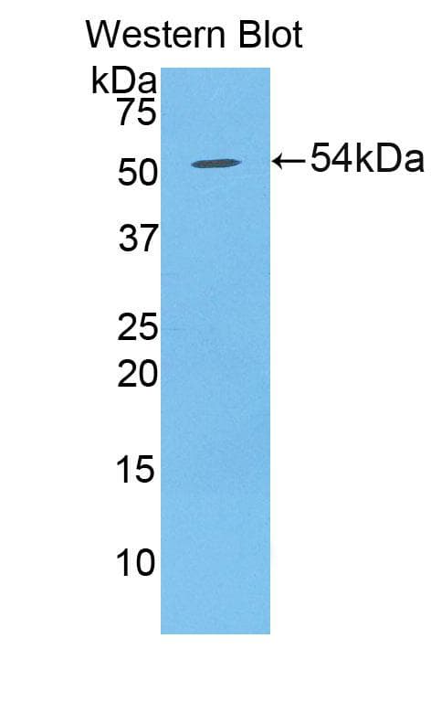 DSG1 / Desmoglein 1 Antibody (aa710-961, Biotin)