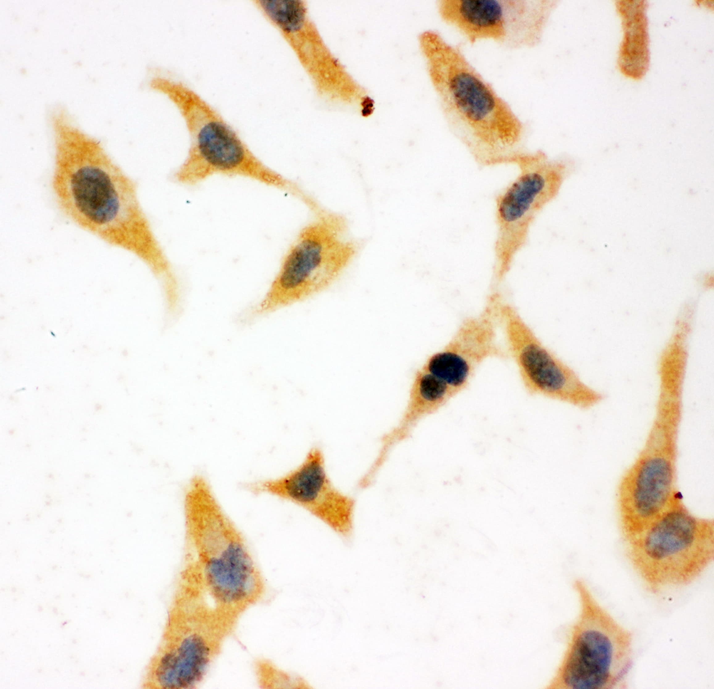 SFN / Stratifin / 14-3-3 Sigma Antibody (aa140-156)