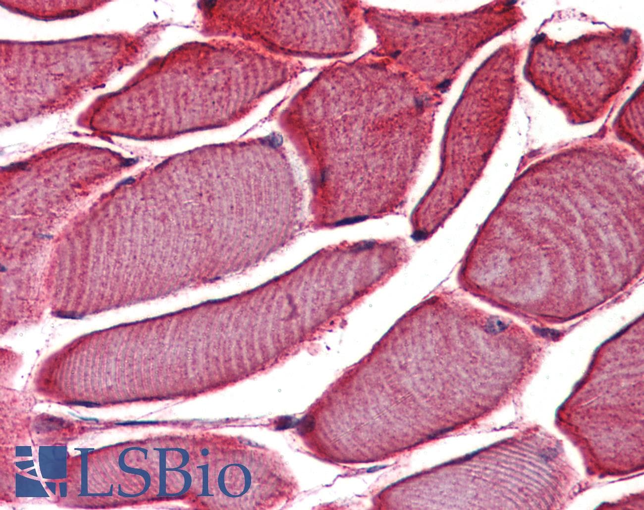 IHC-plus™ VRL1 / TRPV2 Antibody (Internal)