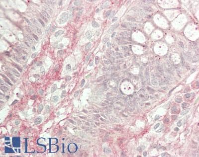 IHC-plus™ Polyclonal Rabbit anti-Human TNF Alpha Antibody (aa77-233, IHC, WB)