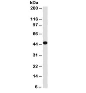 Cytokeratin 1+8 Antibody (clone C-04 or Ks18.04)