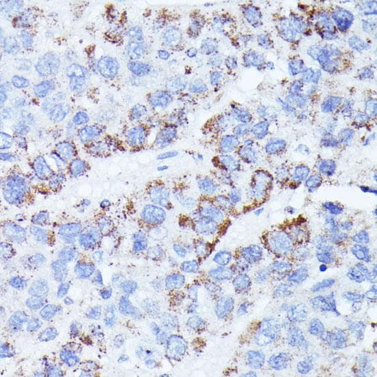 CCDC6 Antibody