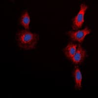 MTOR Antibody (phospho-S2448)