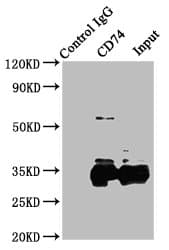 Polyclonal Rabbit anti-Human CD74 / CLIP Antibody (aa137-296, IHC)