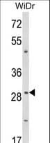 ZFP36 / Tristetraprolin Antibody (aa116-142)