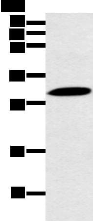 YRDC Antibody