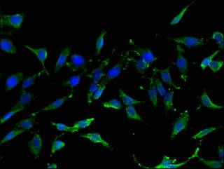 Polyclonal Rabbit anti-Human TIGAR Antibody (IHC, IF)