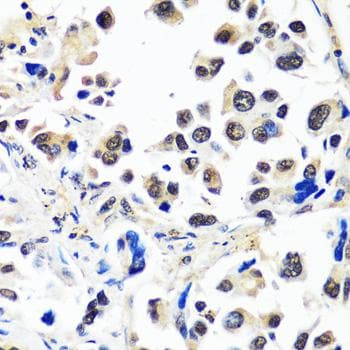 TIP120 / CAND1 Antibody