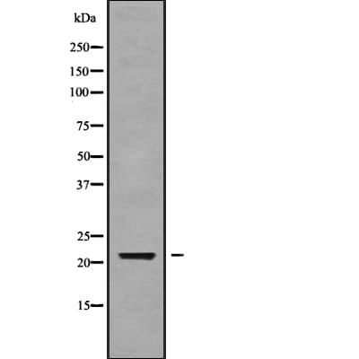 CALML6 Antibody