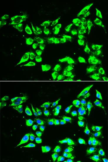 IHC-plus™ KLK10 / Kallikrein 10 Antibody
