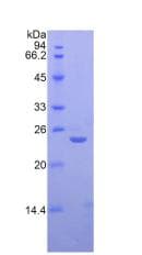 Human SIGLEC12 Protein (Recombinant His)