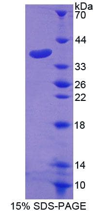 Human SLC20A1 Protein (Recombinant His-T7, N-terminus)