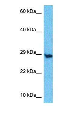 EMC10 Antibody (C-Terminus)