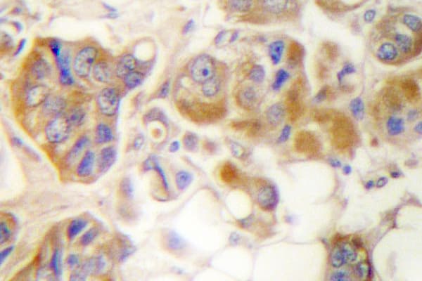 COL1A2 / Collagen I Alpha 2 Antibody (Ser3)