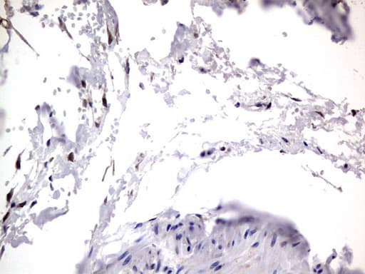 PRX-1 / PRRX1 Antibody (clone OTI1E10)