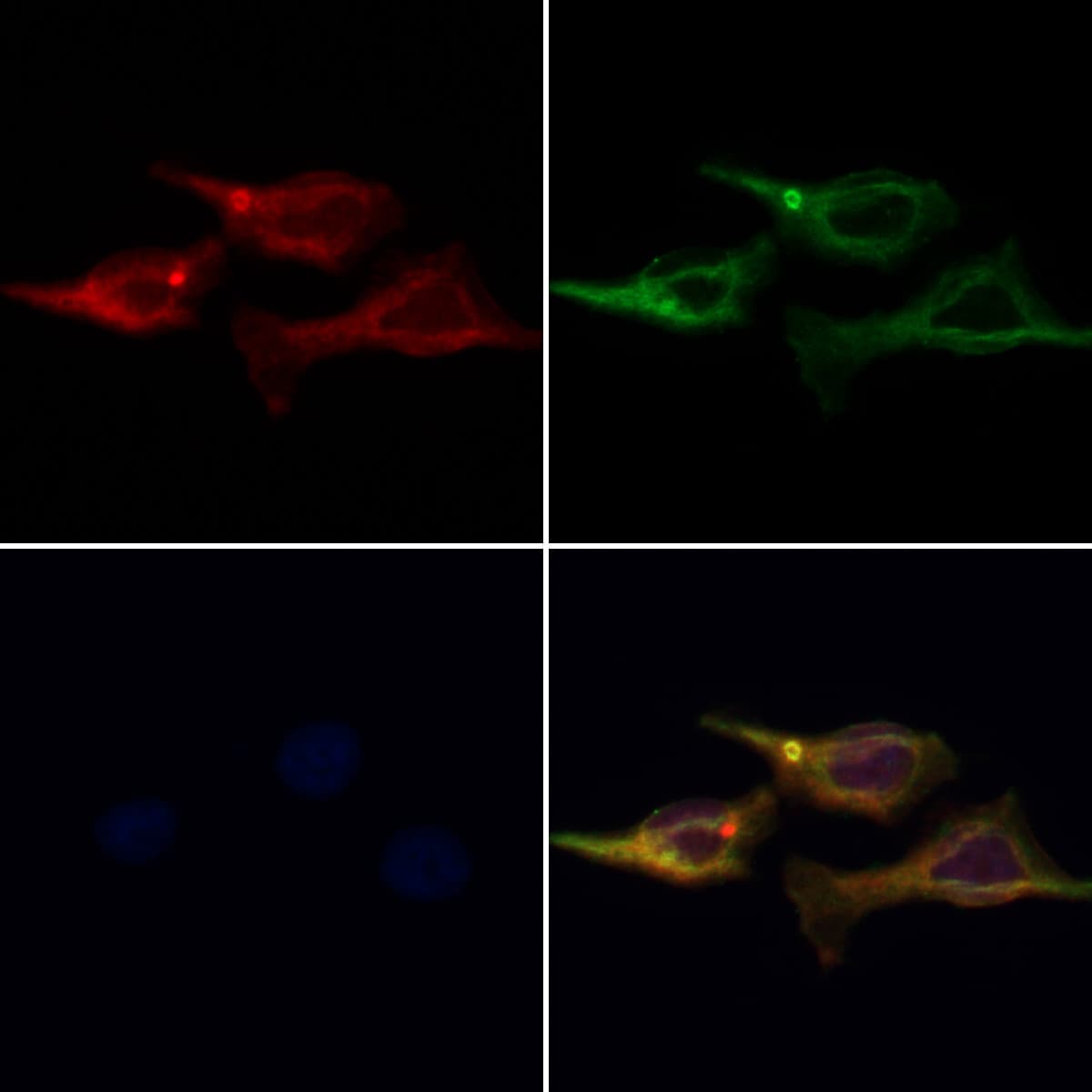 AP3M1 Antibody