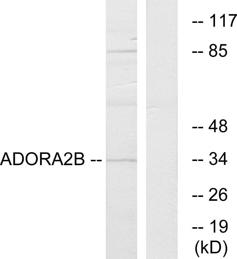 ADORA2B/Adenosine A2B Receptor Antibody