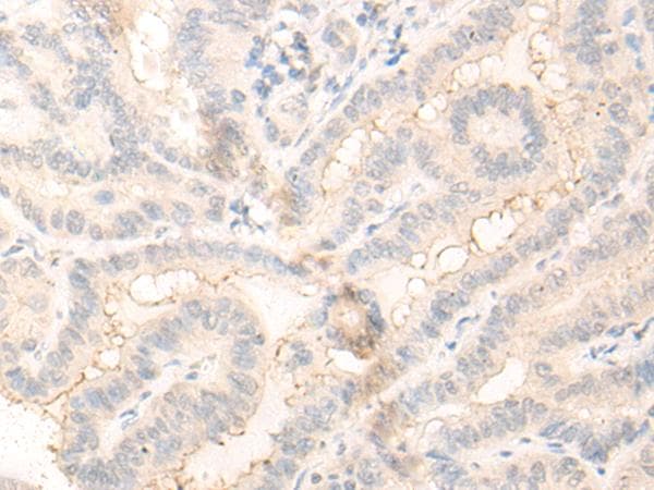 Polyclonal Rabbit anti-Human RADIL Antibody (IHC)