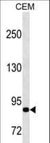 MMP9 / Gelatinase B Antibody