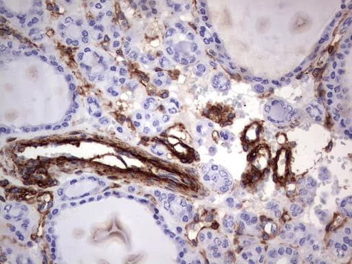 MCAM / CD146 Antibody (clone UMAB155)