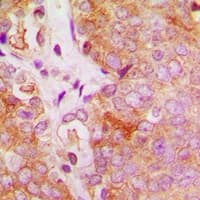 FES Antibody (Internal)