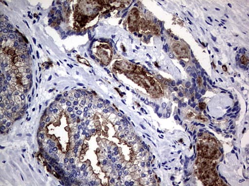 Monoclonal Mouse anti-Human CEACAM5 / CD66e Antibody (clone OTI5F2, aa35-680, IHC, WB)