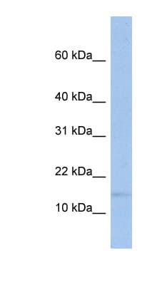 TRAPPC2 / SEDL Antibody (C-Terminus)