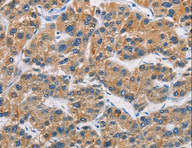 Ceramide Kinase / CERK Antibody