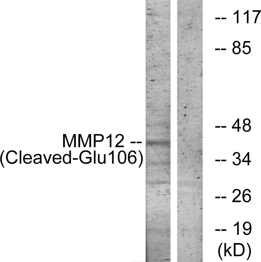 Polyclonal Rabbit anti-Human MMP12 Antibody (Cleaved-Glu106, WB)