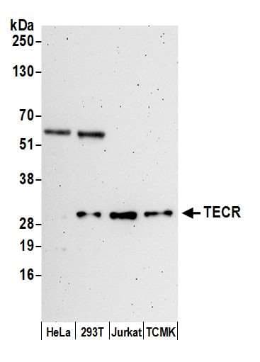 Polyclonal Rabbit anti-Human TECR / TER Antibody (aa200-250, WB)