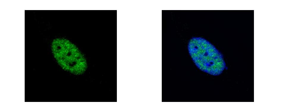 Polyclonal Rabbit anti-Human NEK4 Antibody (aa241-504, IHC, WB)