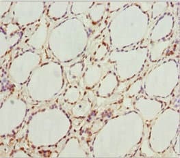 GNB1L / FKSG1 Antibody