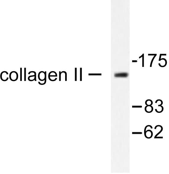 COL2A1 / Collagen II Alpha 1 Antibody (Pro133)