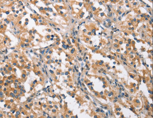 CHMP1A Antibody